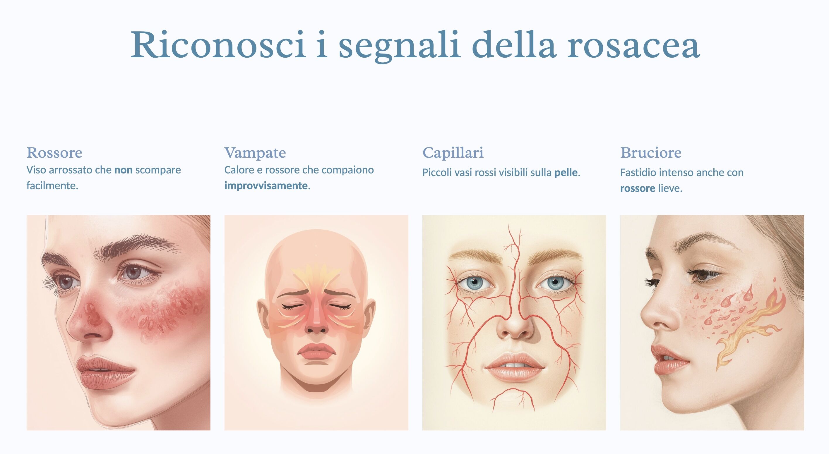 rosacea sitomi